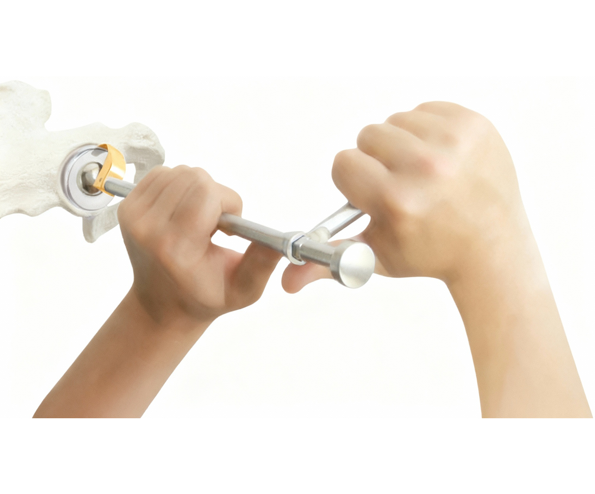 CupX – Sistema de Extração de Componente Acetabular - Imagem 4